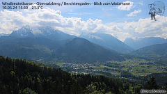 Webcam Obersalzberg - Windbeutelbaron - Berchtesgaden - Watzmann